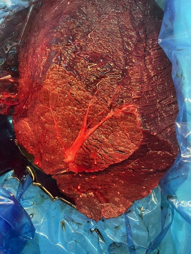 クジラ赤肉約3kg